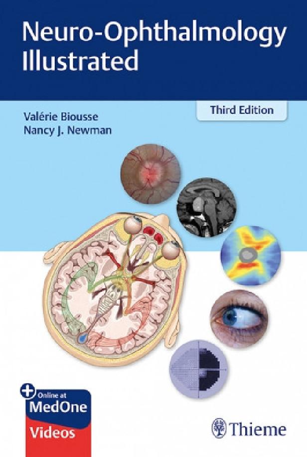 NEURO-OPHTHALMOLOGY ILLUSTRATED