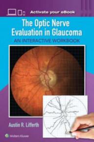THE OPTIC NERVE EVALUATION...