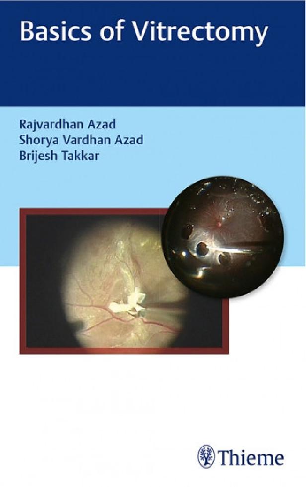 BASICS OF VITRECTOMY