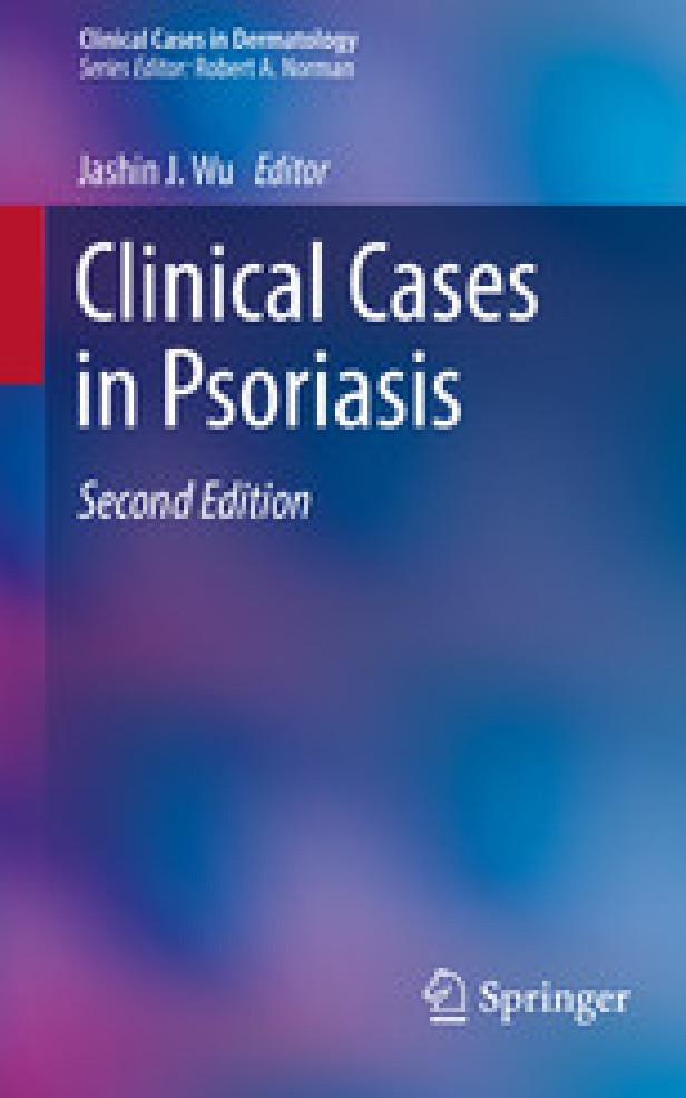 Clinical cases in psoriasis