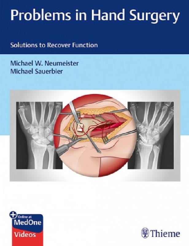 PROBLEMS IN HAND SURGERY - SOLUTIONS TO RECOVER FUNCTION