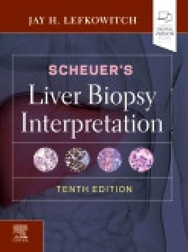 SCHEUER'S LIVER BIOPSY INTERPRETATION, 10TH EDITION