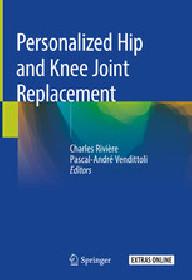 PERSONALIZED HIP AND KNEE...