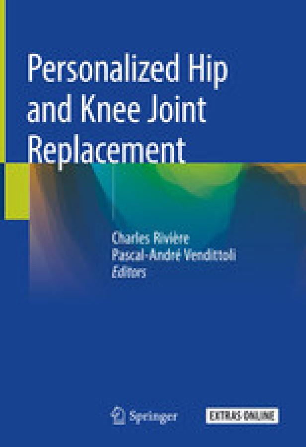 PERSONALIZED HIP AND KNEE JOINT REPLACEMENT