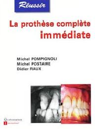 REUSSIR LA PROTHESE...