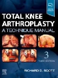 TOTAL KNEE ARTHROPLASTY,...