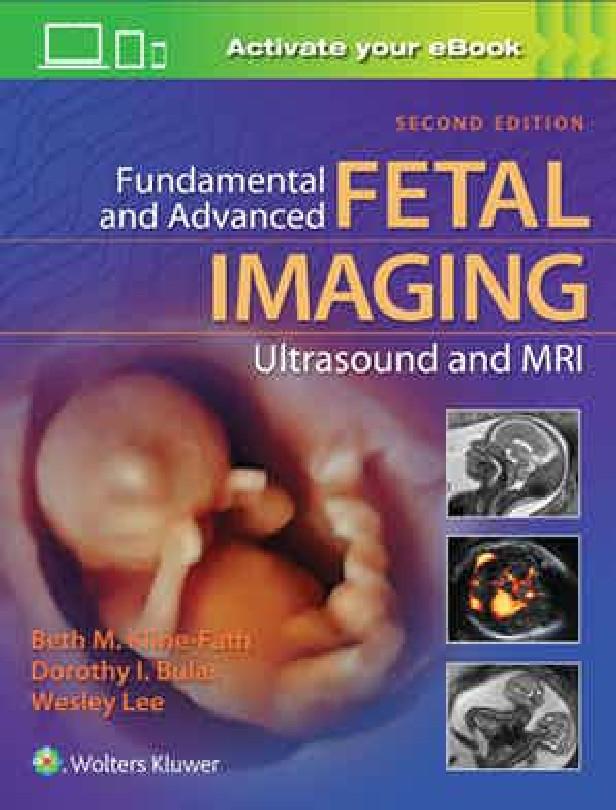 FUNDAMENTAL AND ADVANCED FETAL IMAGING - ULTRASOUND AND MRI 2ND ED