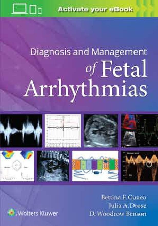 DIAGNOSIS AND MANAGEMENT OF FETAL ARRHYTHMIAS