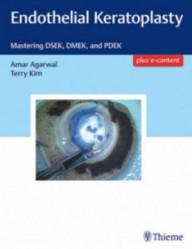 ENDOTHELIAL KERATOPLASTY