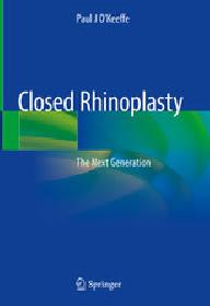 CLOSED RHINOPLASTY
