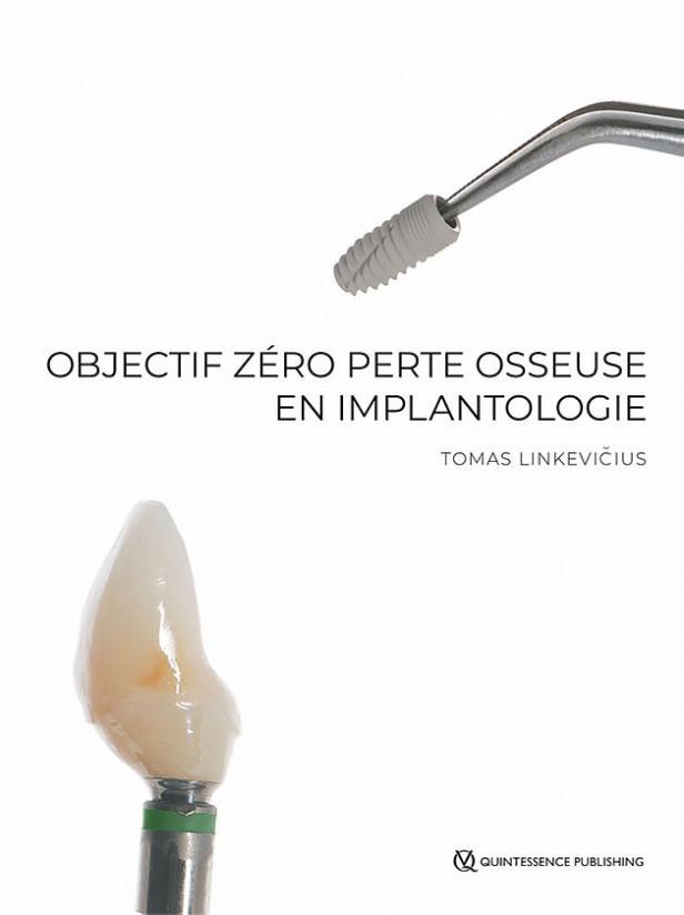 OBJECTIF ZERO PERTE OSSEUSE EN IMPLANTOLOGIE