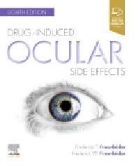 DRUG-INDUCED OCULAR SIDE...