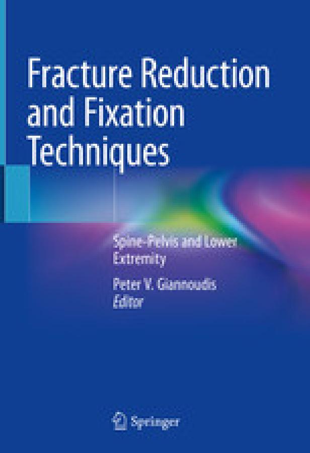 Fracture reduction and fixation techniques- spine-pelvis and lower extremity