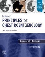 Felson's principles of...