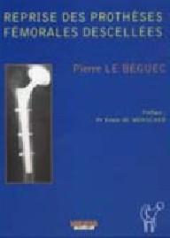 REPRISES DES PROTHESES...