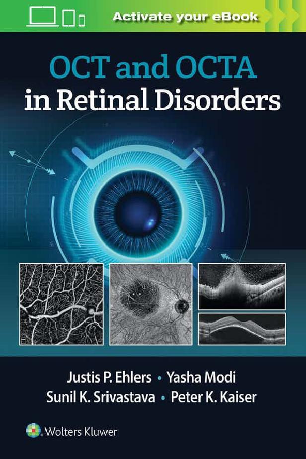 OCT AND OCT ANGIOGRAPHY IN RETINAL DISORDERS