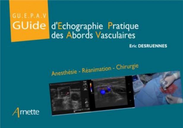 GUIDE D'ECHOGRAPHIE PRATIQUE ET ABORDS VASCULAIRES (GU.E.P.A.V) - ANESTHESIE - REANIMATION - MEDECIN