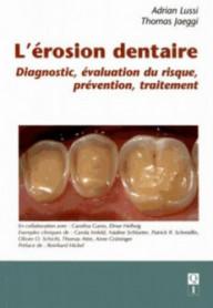 L'érosion dentaire :...
