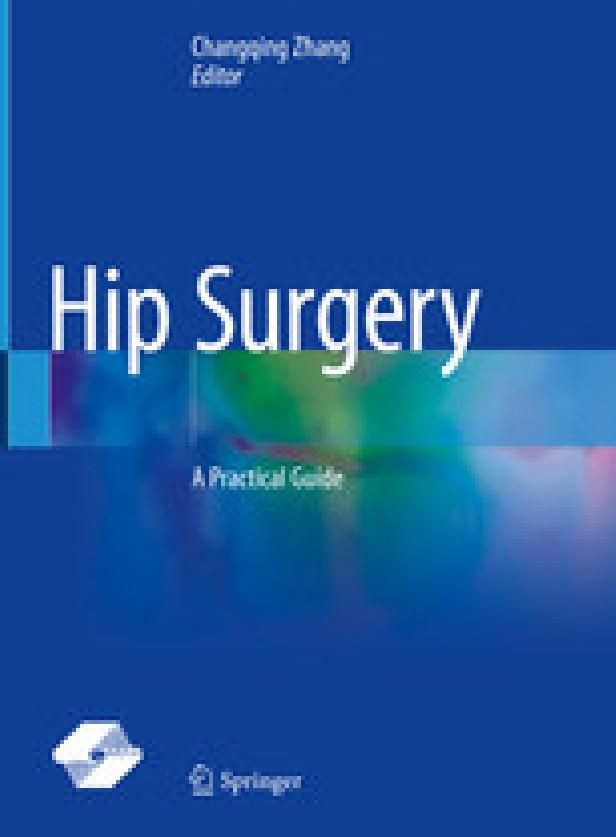 HIP SURGERY - A PRACTICAL GUIDE