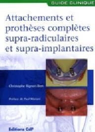 ATTACHEMENTS ET PROTHESES...