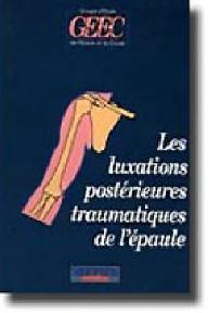 LES LUXATIONS POSTERIEURES...