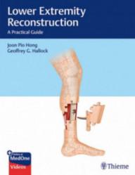 LOWER EXTREMITY...