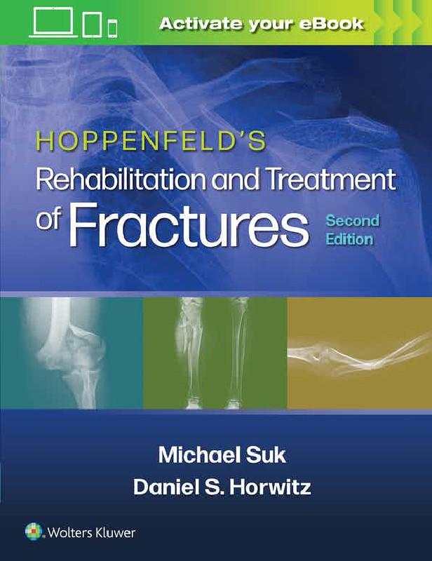 Hoppenfeld's treatment and rehabilitation of fractures