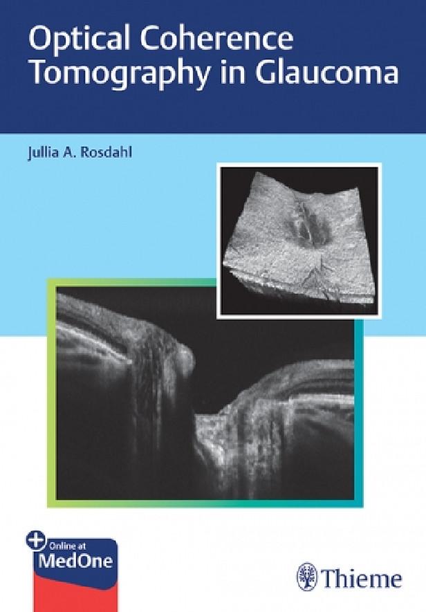 OPTICAL COHERENCE TOMOGRAPHY IN GLAUCOMA