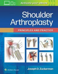 SHOULDER ARTHROPLASTY -...