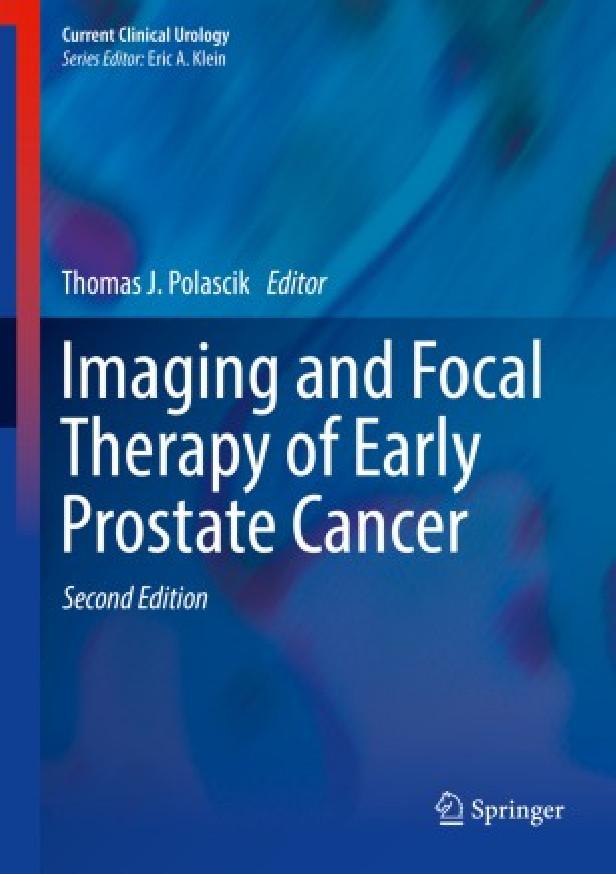 Imaging and focal therapy of early prostate cancer 2nd ed