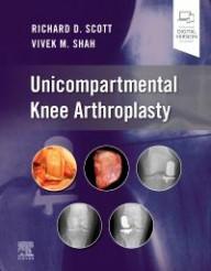 Unicompartmental Knee...