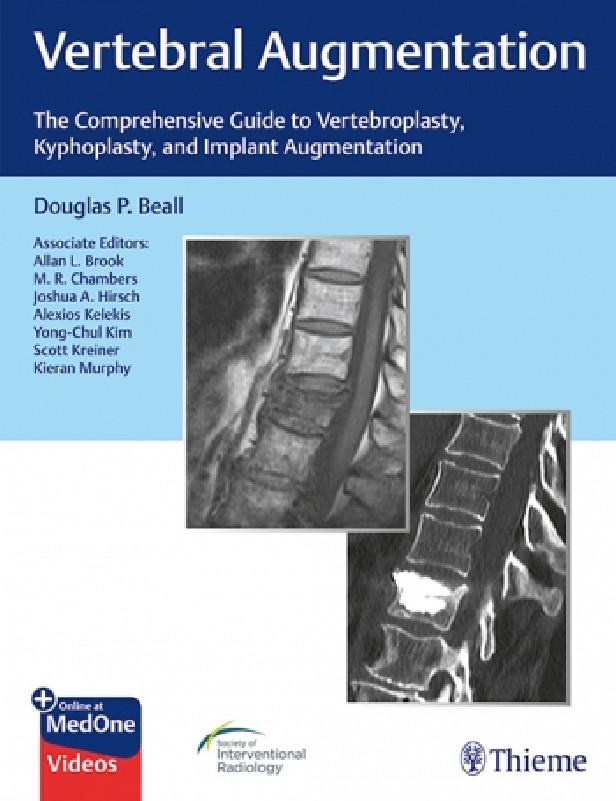 VERTEBRAL AUGMENTATION