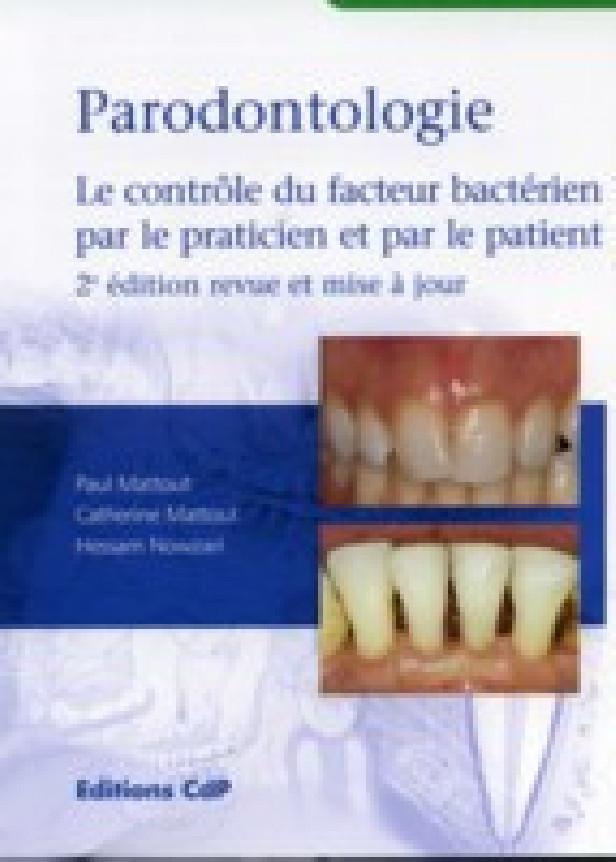 PARODONTOLOGIE - LE CONTROLE DU FACTEUR BACTERIEN PAR LE PRACTICIEN ET PAR LE PATIENT - 2EME EDITION