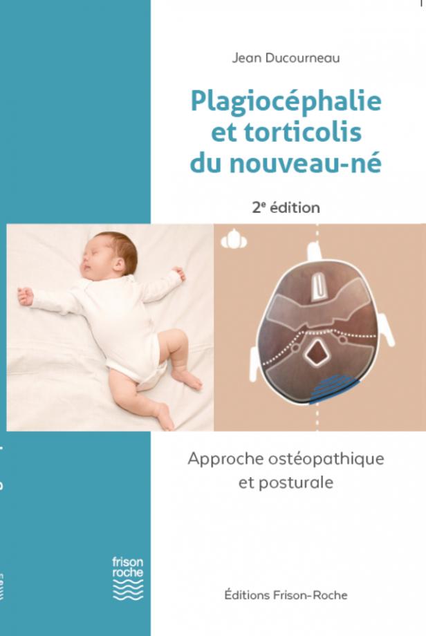 PLAGIOCEPHALIE ET TORTICOLIS DU NOUVEAU_NE - APPROCHE OSTEOPATHIQUE ET POSTURALE