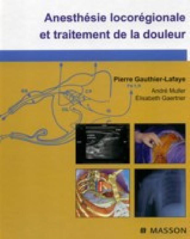 ANESTHESIE LOCO-REGIONALE ET TRAITEMENT DE LA DOULEUR