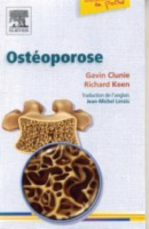 OSTEOPOROSE