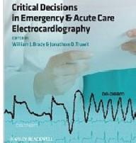 Critical decisions in...