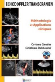 ECHODOPPLER TRANSCRANIEN...