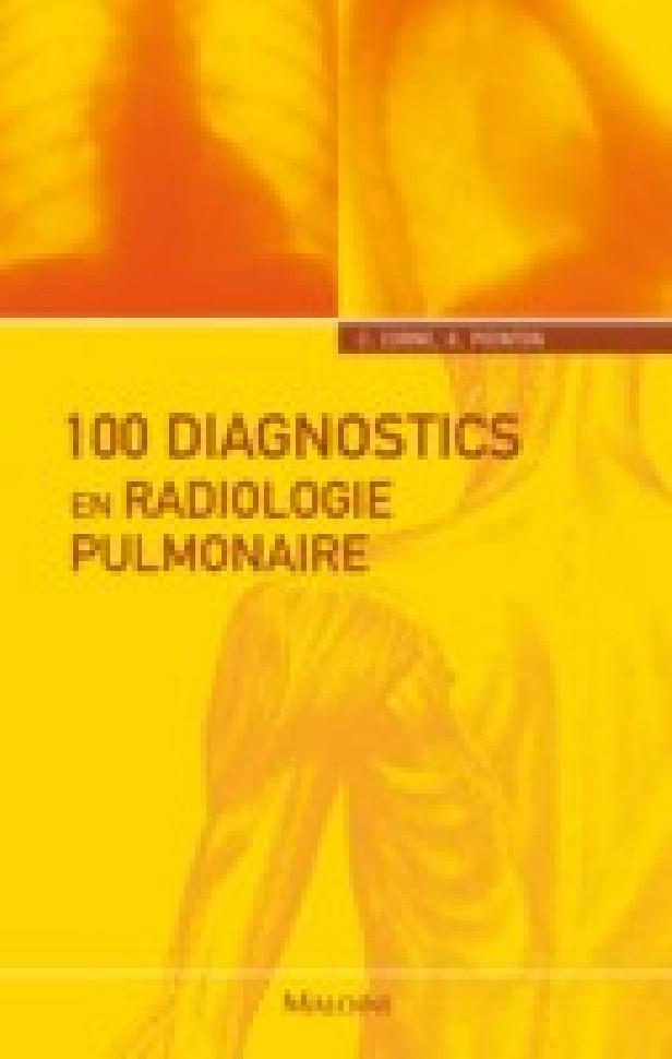 100 DIAGNOSTICS EN RADIOLOGIE PULMONAIRE