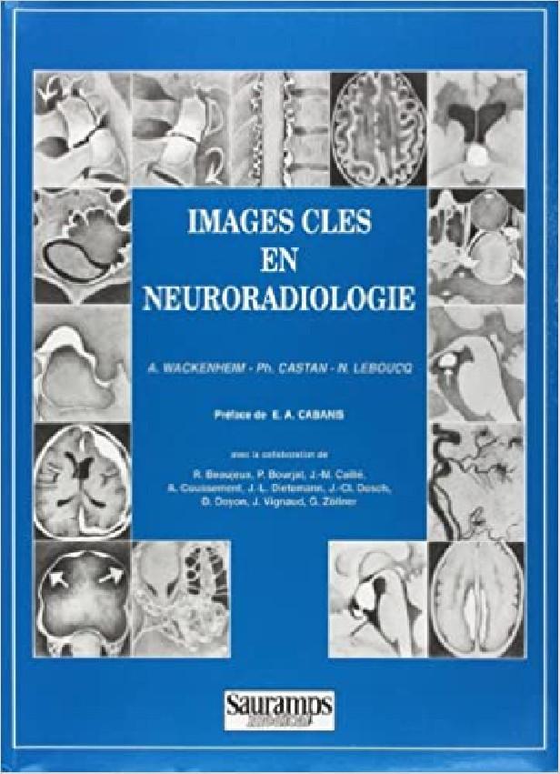 IMAGES CLES EN NEURORADIOLOGIE