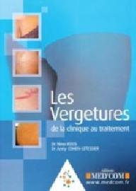 LES VERGETURES