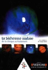LA SECHERESSE OCCULAIRE