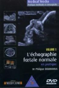 L ECHOGRAPHIE FOETALE...