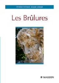 LES BRULURES