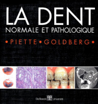 LA DENT NORMALE ET...