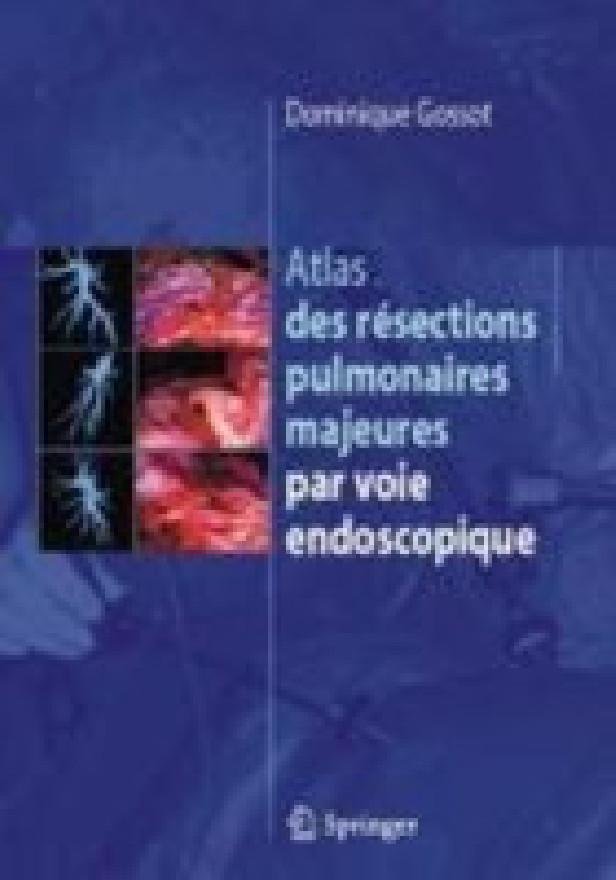 ATLAS DES RESECTIONS PULMONAIRES MAJEURES PAR VOIE ENDOSCOPIQUE