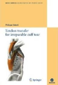 TENDON TRANSFER FOR...