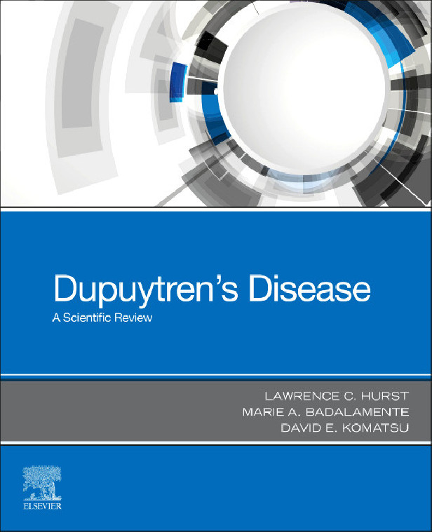 DUPUYTREN'S DISEASE - A SCIENTIFIC REVIEW