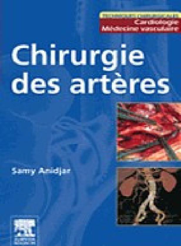 CHIRURGIE DES ARTERES - PILON PARTIEL 15/2/16