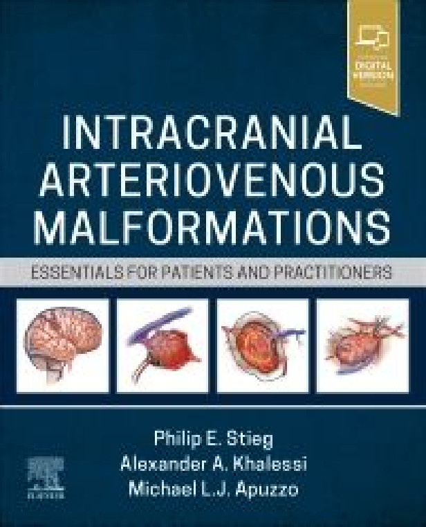 INTRACRANIAL ARTERIOVENOUS MALFORMATIONS